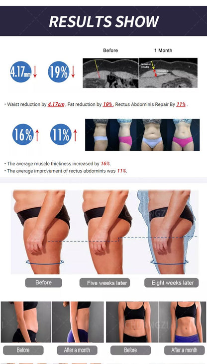SculptMax Pro EMS & RF Body Sculpting 6500W HI-EMT MYOSLIM System