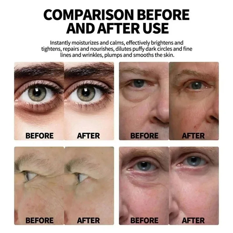 Instant Eye Bag Remove Eye Cream anti Fat Particles Dark Circles Puffiness Fade Fine Lines Lift Brighten Korean Beauty Eye Care