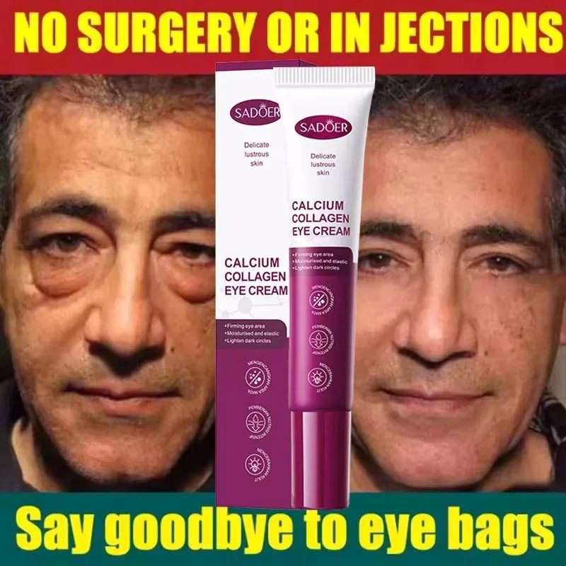 Instant Eye Bag Remove Eye Cream anti Fat Particles Dark Circles Puffiness Fade Fine Lines Lift Brighten Korean Beauty Eye Care