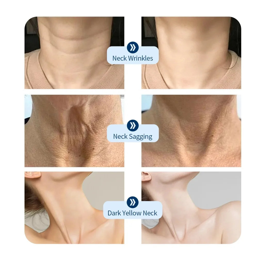 Revitalize Your Neck: LED Lift Mask for Anti-Wrinkle and Skin Brightening