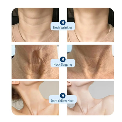 Revitalize Your Neck: LED Lift Mask for Anti-Wrinkle and Skin Brightening